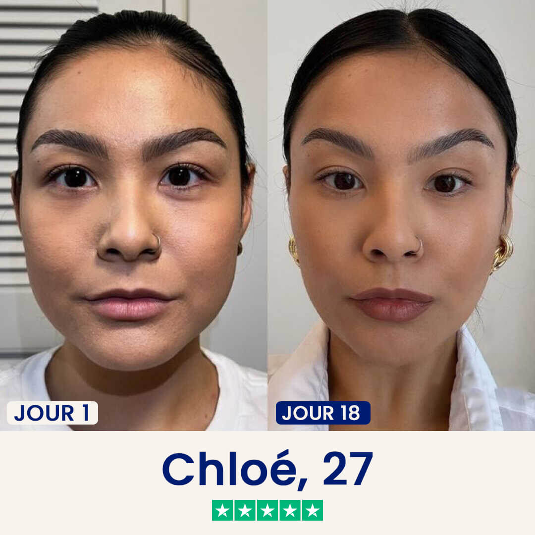 Le Chinology™ Lift (Offre Anniversaire)