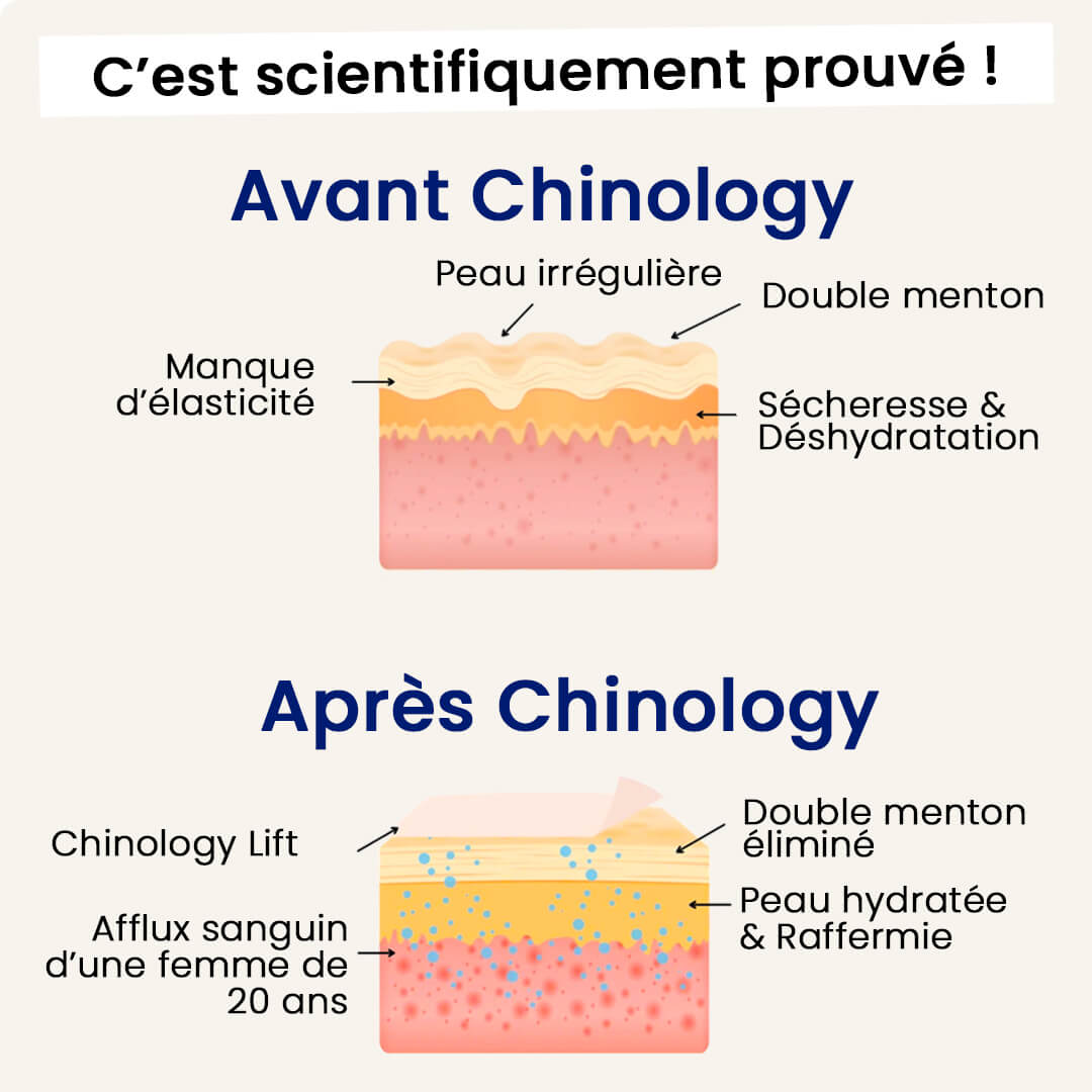 Le Chinology™ Lift (Offre Nouvel An)